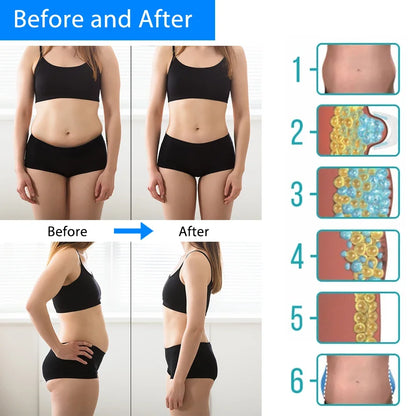 CryoSlim™ Cold Therapy Fat Freezing Belt